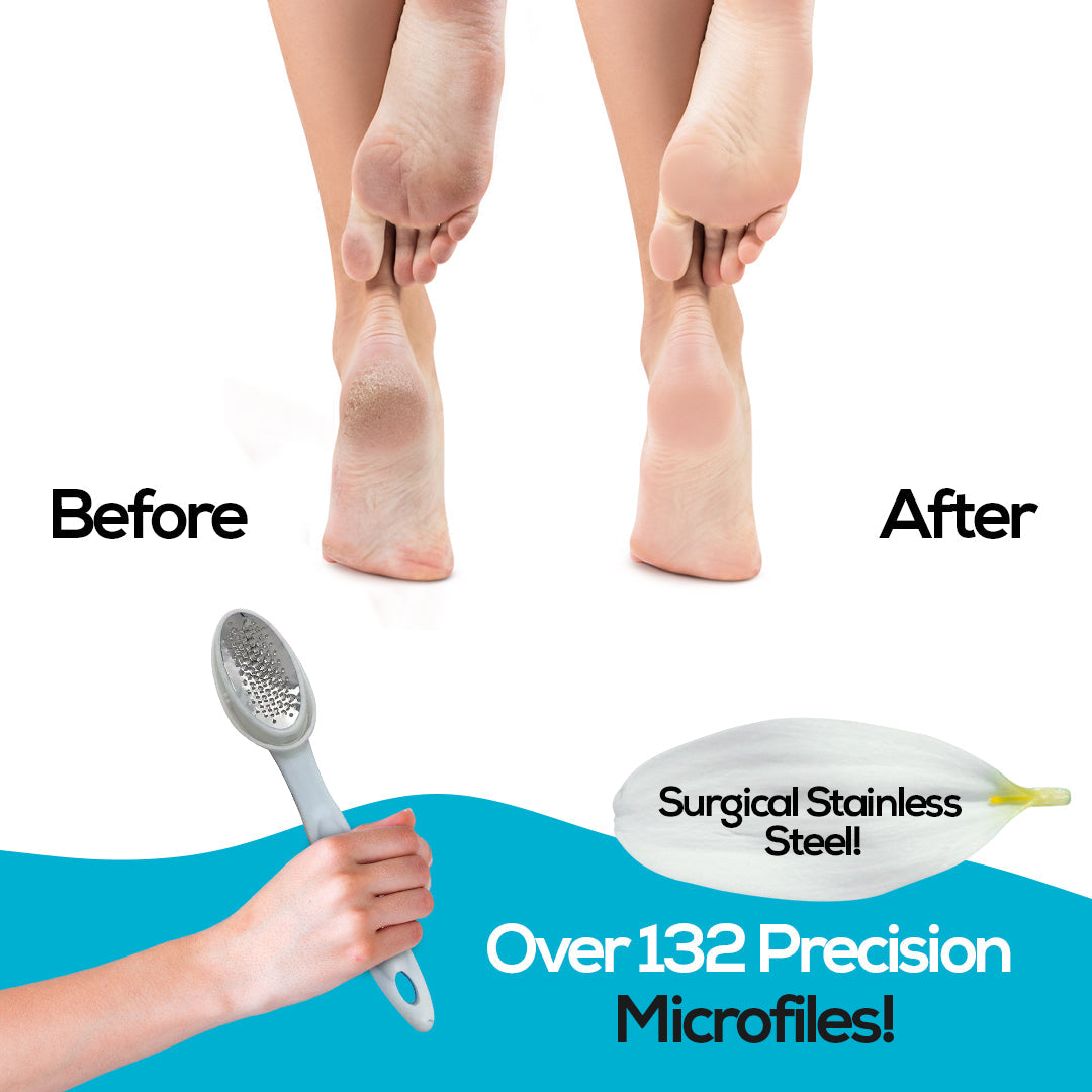 Foot Care Set – Callus Remover & Heel File with Ergonomic Handle