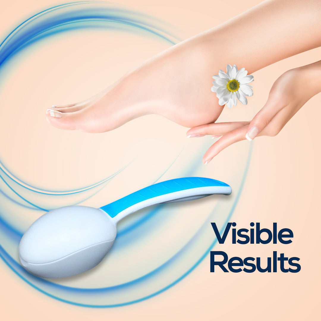 Foot Care Set – Callus Remover & Heel File with Ergonomic Handle