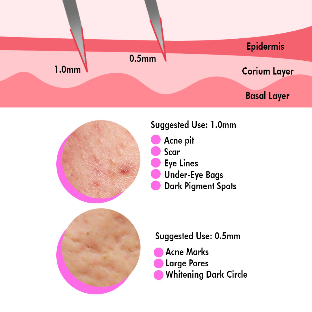 0.5 MM Dermaroller 540 Titanium Micro Needle Roller